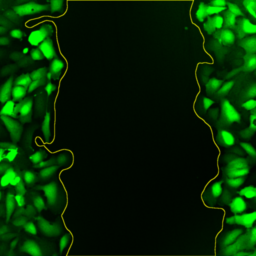 GFP U2OS overlay.png